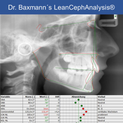 Dr Martin Baxmanns Leancephanalysis