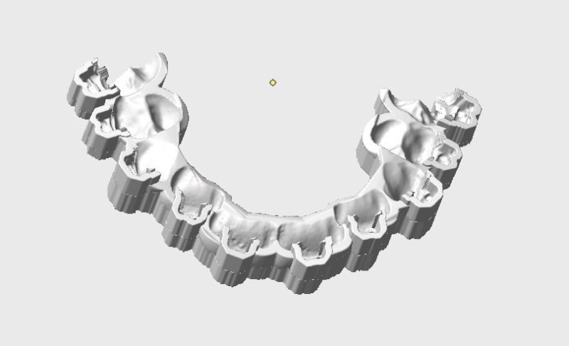 Indirektes Kleben 3d Druck Ok Schiene